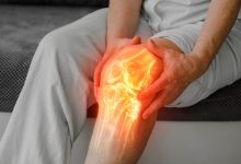 Artrose no joelho Veja quando pode ser hora de pensar em uma prótese