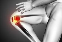 Quanto peso seu joelho realmente suporta